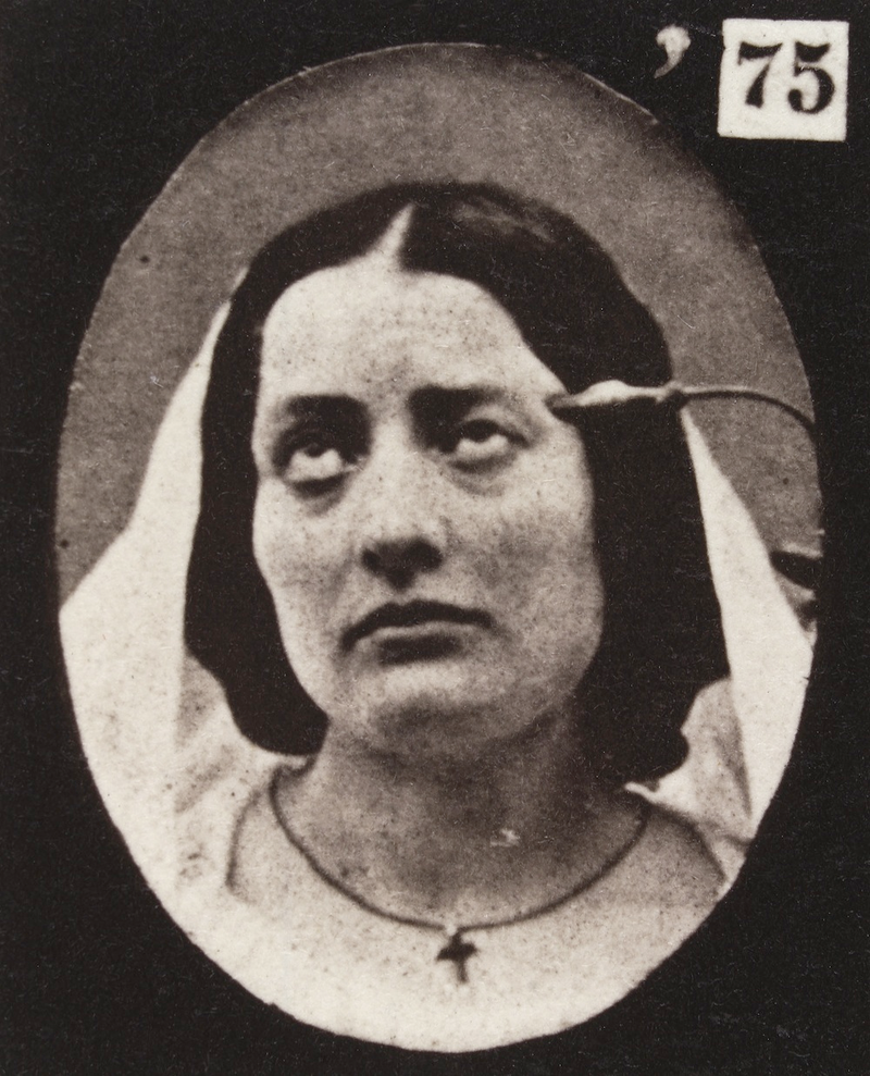 Illustration for article titled Terrifying, Century-Old Photographs from Neuroscience Experiments